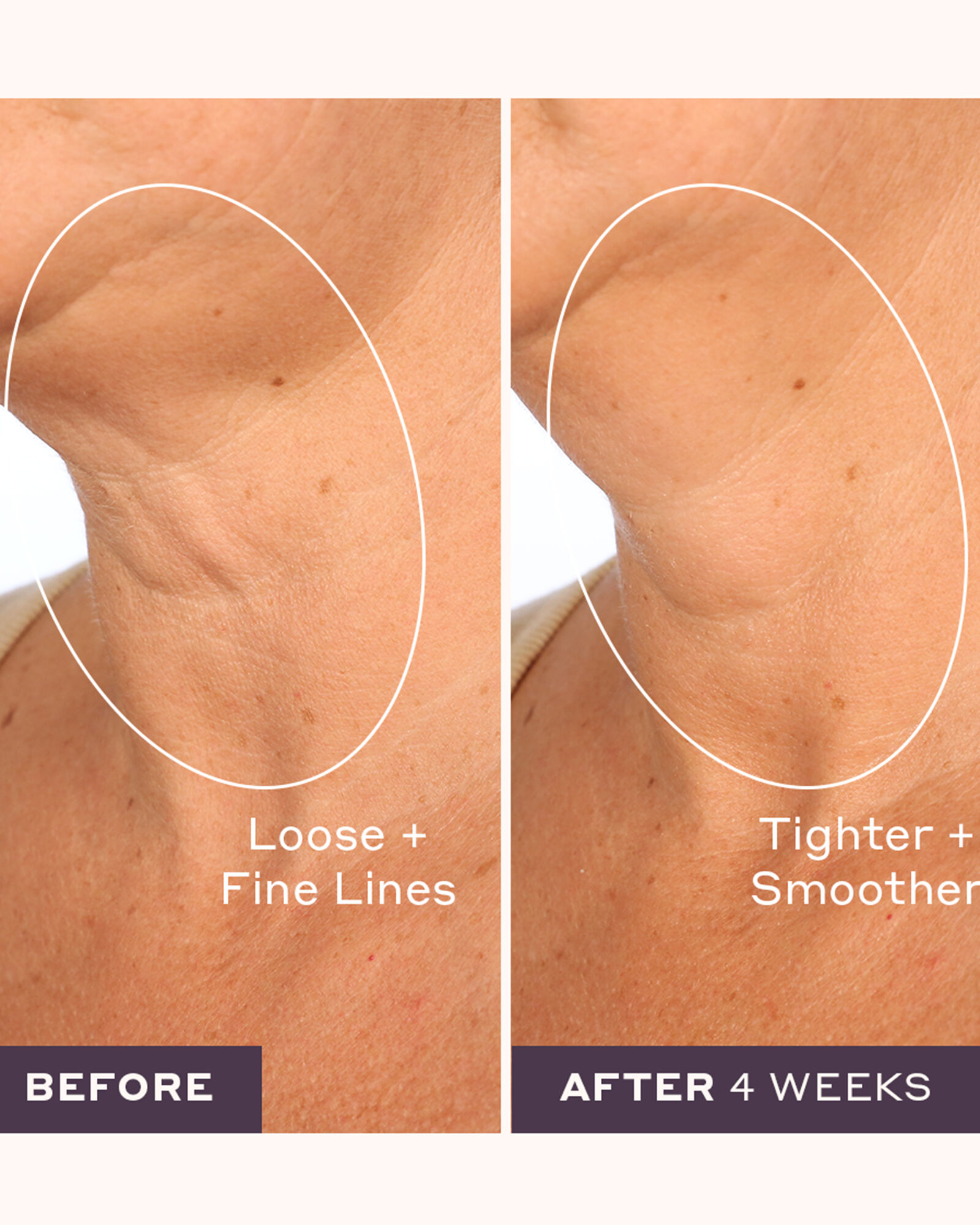 Womaness Let's Neck Serum